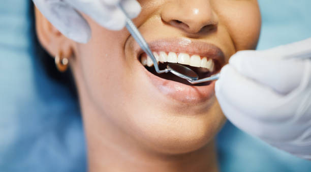 Best Emergency Treatment for Dental Infections or Abscesses in Chardon, OH